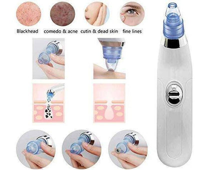 Derma Suction 3 In 1  Blackhead Removal Machine